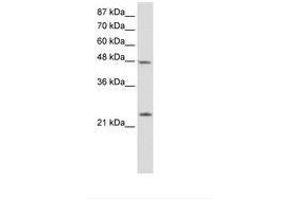 Image no. 1 for anti-Chromobox Homolog 6 (CBX6) (N-Term) antibody (ABIN202464) (CBX6 antibody  (N-Term))