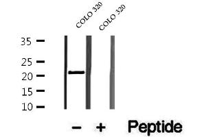 Western blot analysis of extracts of COLO 320 cells, using OBFC2A antibody. (OBFC2A antibody  (Internal Region))
