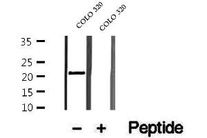 Western blot analysis of extracts of COLO 320 cells, using OBFC2A antibody. (OBFC2A antibody  (Internal Region))