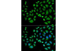 Immunofluorescence analysis of HeLa cell using CLIC1 antibody.