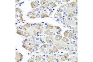Immunohistochemistry of paraffin-embedded human stomach using OTC antibody. (OTC antibody  (AA 215-354))
