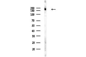 Western blot analysis of lysates from COLO205 cells(UV,30 min treatment), using Rictor Antibody at 1/1000 dilution.