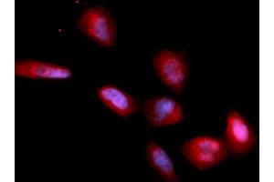Immunofluorescence (IF) image for anti-CD33 (CD33) (AA 18-259) antibody (PE) (ABIN5567445) (CD33 antibody  (AA 18-259) (PE))