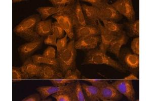 Immunofluorescence analysis of U2OS cells using BID Polyclonal Antibody at dilution of 1:100. (BID antibody)