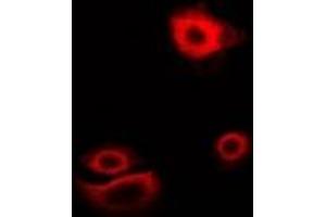 Immunofluorescent analysis of Myotilin staining in U2OS cells. (Myotilin antibody)