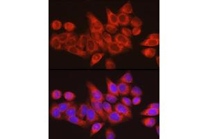 Immunohistochemistry (IHC) image for anti-Mesencephalic Astrocyte-Derived Neurotrophic Factor (MANF) (AA 25-182) antibody (ABIN6143461)