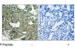 Image no. 3 for anti-Mitogen-Activated Protein Kinase Kinase 1 (MAP2K1) (pSer221), (pSer222) antibody (ABIN196889) (MEK1 antibody  (pSer221, pSer222))