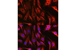 Immunofluorescence analysis of C6 cells using Alpha-tubulin (ubiquitous) chain antibody (ABIN7271033) at dilution of 1:100. (TUBA1B antibody  (AA 1-451))