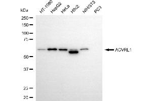 Western blotting analysis using ACVRL1 antibody (ABIN7797490).