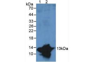 Figure. (S100A9 antibody  (AA 1-114))