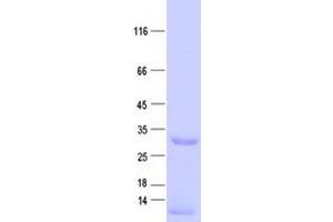 Validation with Western Blot (NAT1 Protein (His tag))
