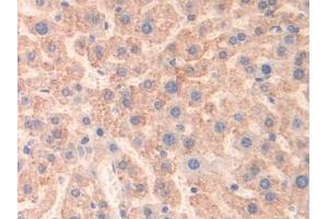 Detection of MAOB in Mouse Liver Tissue using Polyclonal Antibody to Monoamine Oxidase B (MAOB) (Monoamine Oxidase B antibody  (AA 206-505))
