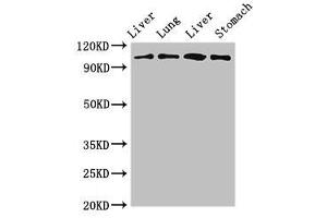 Western Blot Positive WB detected in: Rat liver tissue, Rat lung tissue, Mouse liver tissue, Mouse stomach tissue All lanes: MAP3K13 antibody at 3 μg/mL Secondary Goat polyclonal to rabbit IgG at 1/50000 dilution Predicted band size: 109, 18, 93, 86, 15 kDa Observed band size: 109 kDa (MAP3K13 antibody  (AA 506-835))
