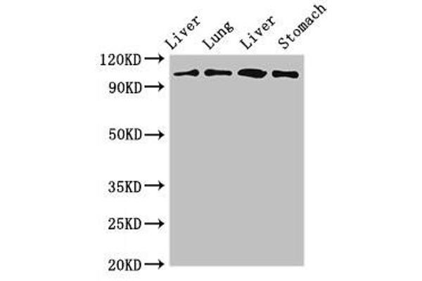 MAP3K13 antibody  (AA 506-835)