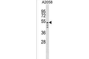 CLEC18C Antibody (C-term) (ABIN1537091 and ABIN2850339) western blot analysis in  cell line lysates (35 μg/lane). (CLEC18C antibody  (C-Term))
