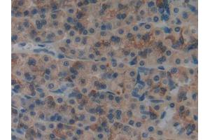 DAB staining on IHC-P; Samples: Rat Stomach Tissue (MYO1F antibody  (AA 655-922))