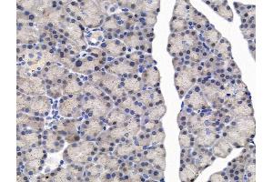 anti-Myeloid/lymphoid Or Mixed-Lineage Leukemia (MLL) (Internal Region) antibody