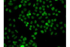 Immunofluorescence analysis of A549 cells using PIP5K1A antibody. (PIP5K1A antibody)