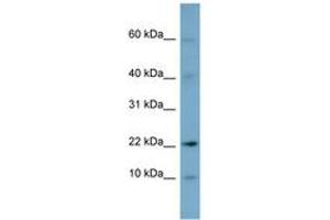 Image no. 1 for anti-Developmental Pluripotency Associated 5 (DPPA5) (N-Term) antibody (ABIN6741859) (DPPA5 antibody  (N-Term))