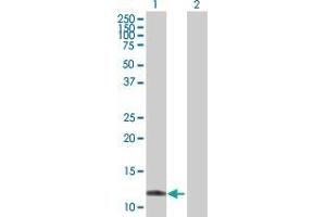 Western Blot analysis of TTLL3 expression in transfected 293T cell line by TTLL3 MaxPab polyclonal antibody. (TTLL3 antibody  (AA 1-101))