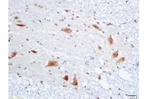 Formalin-fixed and paraffin embedded rat spinal cord labeled with Anti-PMP22 Polyclonal Antibody, Unconjugated  at 1:200 followed by conjugation to the secondary antibody and DAB staining (PMP22 antibody  (AA 101-160))