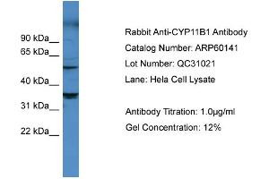 WB Suggested Anti-CYP11B1  Antibody Titration: 0. (CYP11B1 antibody  (Middle Region))