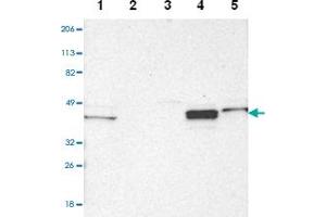 Western blot analysis of Lane 1: Human cell line RT-4, Lane 2: Human cell line U-251MG sp, Lane 3: Human cell line A-431, Lane 4: Human liver tissue, Lane5: Human tonsil tissue with NDRG2 polyclonal antibody  at 1:2500-1:5000 dilution.