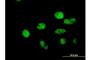 Immunofluorescence of purified MaxPab antibody to MSH2 on HeLa cell.