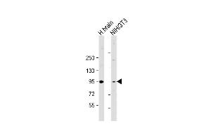 All lanes : Anti-PRKD2 Antibody (Center) at 1:2000 dilution Lane 1: human brain lysate Lane 2: NIH/3T3 whole cell lysate Lysates/proteins at 20 μg per lane. (PKD2 antibody  (AA 556-590))