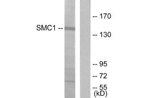 Western blot analysis of extracts from 293 cells, treated with UV (15mins), using SMC1 (epitope around residue 957) antibody. (SMC1A antibody  (Ser957))