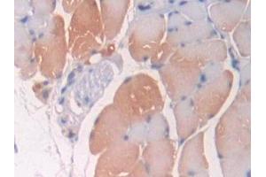 Detection of OPTN in Mouse Skeletal muscle Tissue using Polyclonal Antibody to Optineurin (OPTN) (OPTN antibody  (AA 1-300))