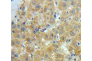 Used in DAB staining on fromalin fixed paraffin-embedded Liver tissue (Caldesmon antibody  (AA 28-207))