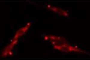 ABIN6275717 staining  HepG2 cells by IF/ICC. (TAZ antibody  (Internal Region))