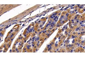 Immunohistochemistry (IHC) image for anti-Mitogen-Activated Protein Kinase Kinase 6 (MAP2K6) (AA 46-306) antibody (ABIN7443209)