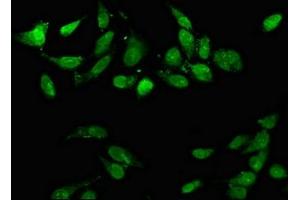 Immunofluorescence staining of Hela cells with ABIN7150414 at 1:66, counter-stained with DAPI. (CD3EAP antibody  (AA 289-404))