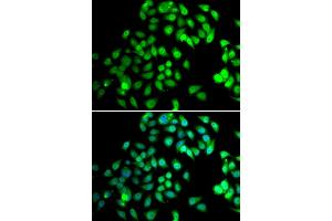 Immunofluorescence analysis of MCF-7 cells using NCBP2 antibody (ABIN5974395).