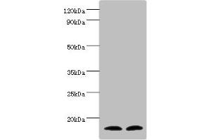 Western blot All lanes: Protachykinin-1 antibody at 6 μg/mL Lane 1: Mouse liver tissue Lane 2: 293T whole cell lysate Secondary Goat polyclonal to rabbit IgG at 1/10000 dilution Predicted band size: 16, 14, 12 kDa Observed band size: 16 kDa (TAC1 antibody  (AA 1-129))