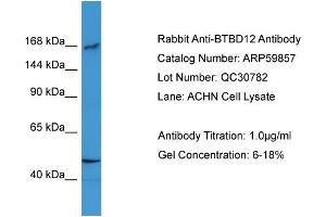 WB Suggested Anti-BTBD12  Antibody Titration: 0.