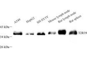 Western blot analysis of TAS2R39 (ABIN7075834) at dilution of 1: 600 (TAS2R39 antibody)