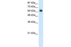 Western Blotting (WB) image for anti-Forkhead Box G1 (FOXG1) antibody (ABIN2461750) (FOXG1 antibody)