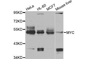 Western blot analysis of extracts of various cell lines, using MYC antibody (ABIN5996012) at 1/1000 dilution. (c-MYC antibody)