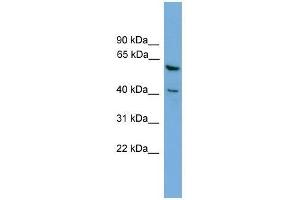 PINX1 antibody used at 0. (PINX1 antibody  (Middle Region))
