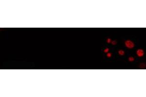 ABIN6274307 staining HeLa cells by IF/ICC. (SRSF3 antibody  (C-Term))