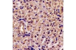Immunohistochemical analysis of ABAT staining in rat kidney formalin fixed paraffin embedded tissue section. (ABAT antibody)