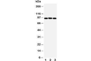 Western blot testing of ABCB6 antibody and Lane 1:  HeLa;  2: MCF-7;  3: A549 cell lysate. (ABCB6 antibody  (C-Term))