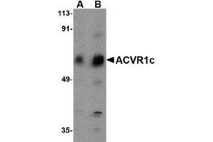 Western blot analysis of ACVR1C in human placenta tissue lysate with AP30016PU-N ACVR1C antibody at (A) 1 and (B) 2 μg/ml. (ACVR1C/ALK7 antibody  (N-Term))