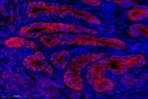 Immunofluorescent analysis of paraformaldehyde-fixed mouse uterus using,NCKAP1 (ABIN7074784) at dilution of 1: 1000 (NCKAP1 antibody)