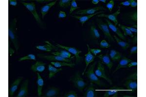 Immunofluorescence of purified MaxPab antibody to SMN2 on HeLa cell. (SMN2 antibody  (AA 1-282))