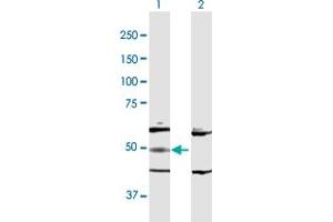 Adenylosuccinate Lyase antibody  (AA 1-484)