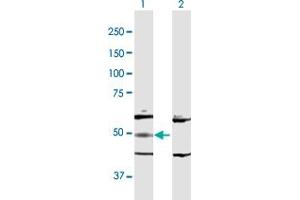 Western Blot analysis of ADSL expression in transfected 293T cell line by ADSL MaxPab polyclonal antibody.